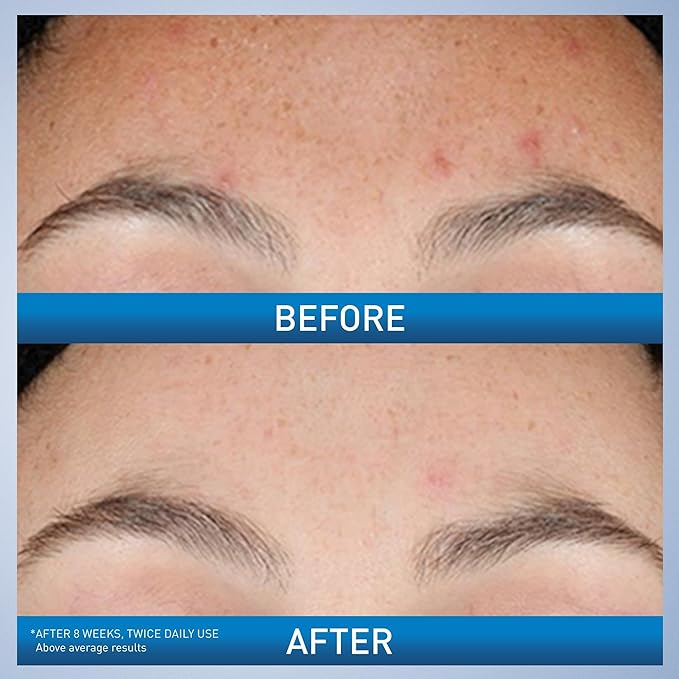 CeraVe Hydating retinol serum 30 ml