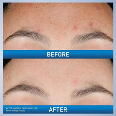 CeraVe Hydating retinol serum 30 ml