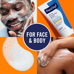 A maximum strength acne treatment products